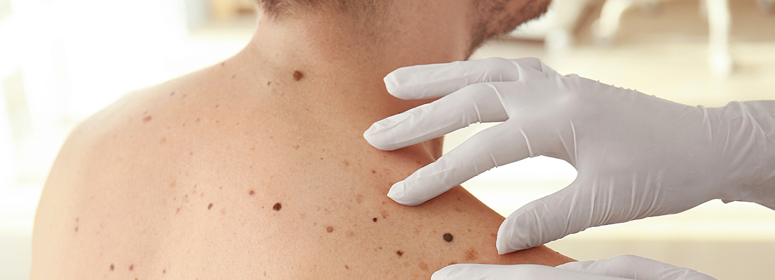 تشخیص بیماری از روی علائم پوستی